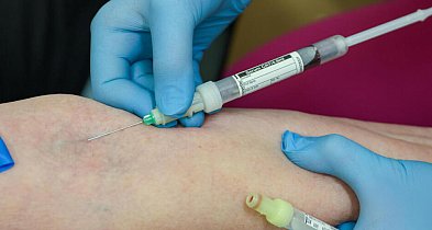 Hematolog: coraz więcej pacjentów z chorobami hematologicznymi-28432